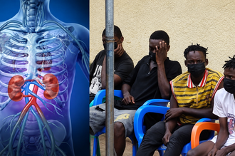 Kidney Trafficking: Police Arrest Two Doctors, Recruiter In Nasarawa