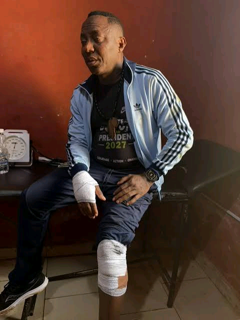 Sowore: 'They Want Me Dead', Accuses Govt After Ekiti Attack 3 Sowore: 'They Want Me Dead', Accuses Govt After Ekiti Attack